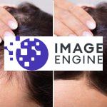 before and after hair loss treatment